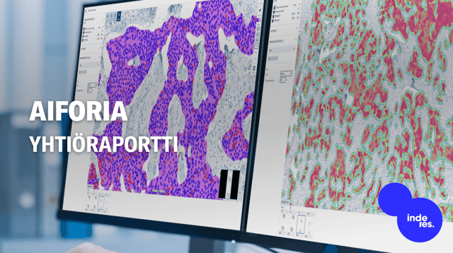 Aiforia: Vyönkiristyksellä asemoidutaan skaalausvaiheeseen